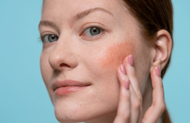 korean skincare